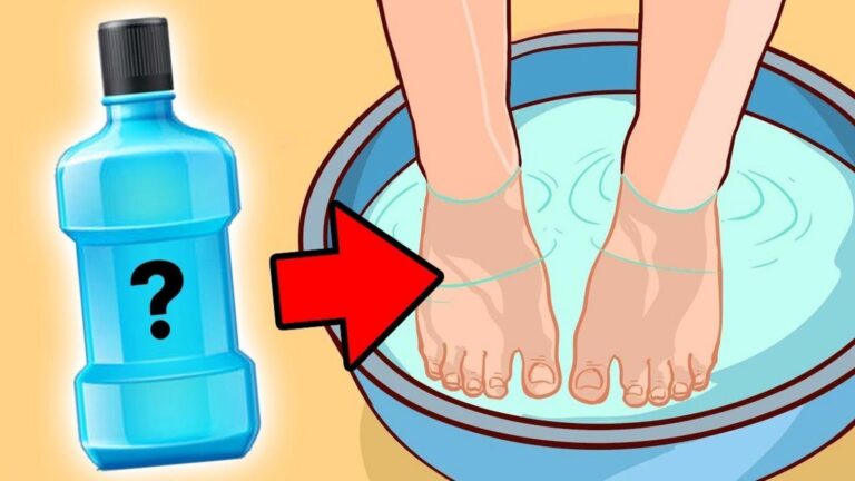 Diese simple Methode lässt Nagelpilz verschwinden – und du wirst staunen …
