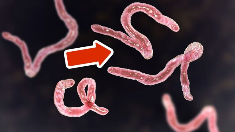 6 natürliche Methoden, um Parasiten effektiv loszuwerden und gesund zu bleiben!