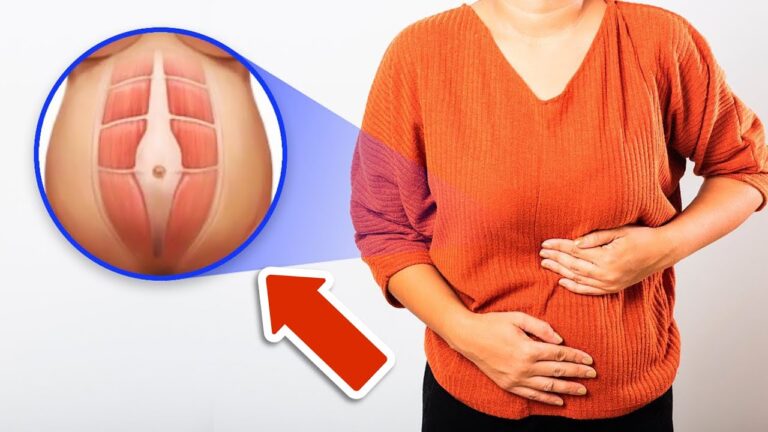 5 einfache Tipps gegen Blähungen im Oberbauch: So fühlst du dich wieder wohl!