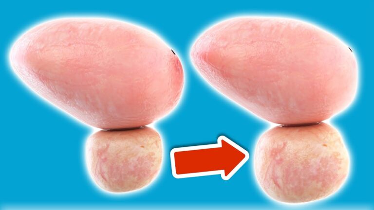 7 klare Warnzeichen für eine vergrößerte Prostata, die du kennen solltest!