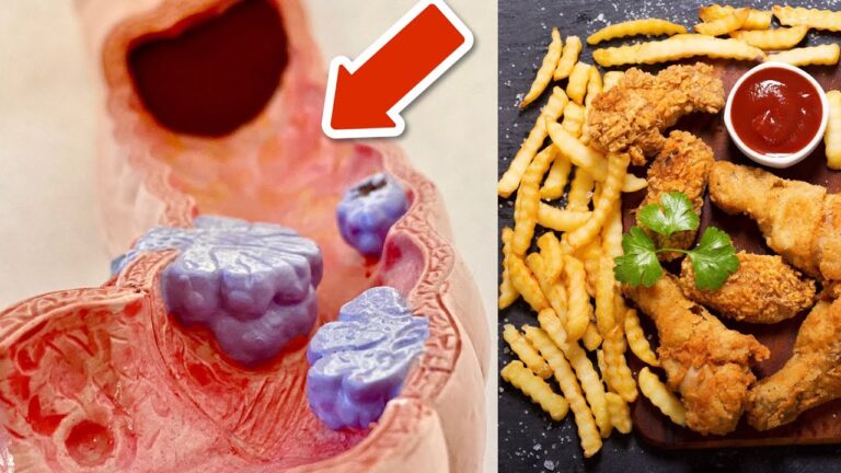 6 Lebensmittel, die bei Darmkrebs tabu sind – so schützt du deine Gesundheit!