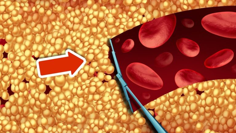 8 einfache Tipps, um dein Cholesterin natürlich zu senken und gesünder zu leben!